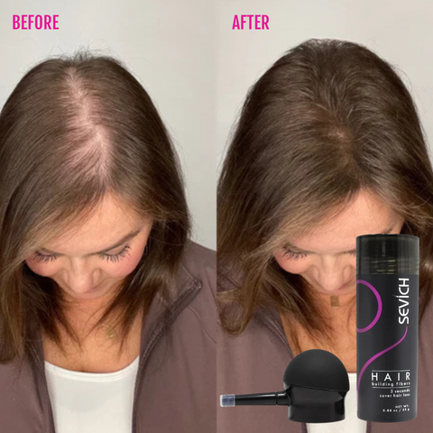 Sevich™ Thickening Hair Fibers